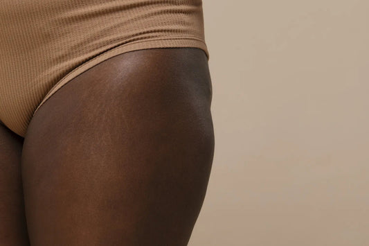 19 Ways to Eliminate Stretch Marks From Your Body in Nigeria - Nectar Beauty Hub